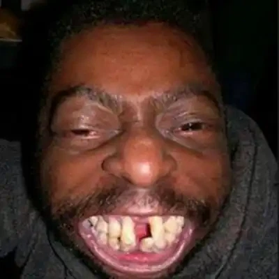 Kumpulan Foto Orang Gila Ketawa, Gokil Banget Bre! 7 foto orang gila ketawa