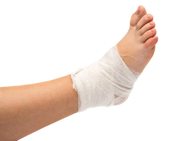 Kumpulan Foto Kaki Diperban Seperti Habis Kecelakaan 14 kaki diperban