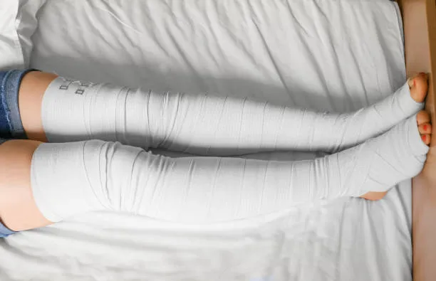 Kumpulan Foto Kaki Diperban Seperti Habis Kecelakaan 4 kaki diperban